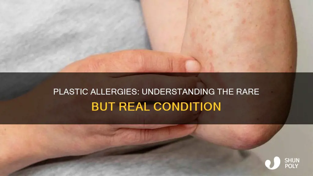 how many people are allergic to plastic