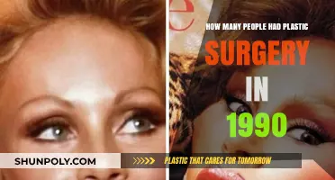 Plastic Surgery Trends: 1990's Popularity and Patient Numbers