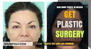 Rising Trend: Plastic Surgery Popularity Among Mexico's Population