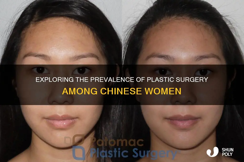 how many percent of chinese women had plastic surgery