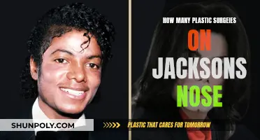Plastic Surgery Obsession: Jackson's Nose Job Count