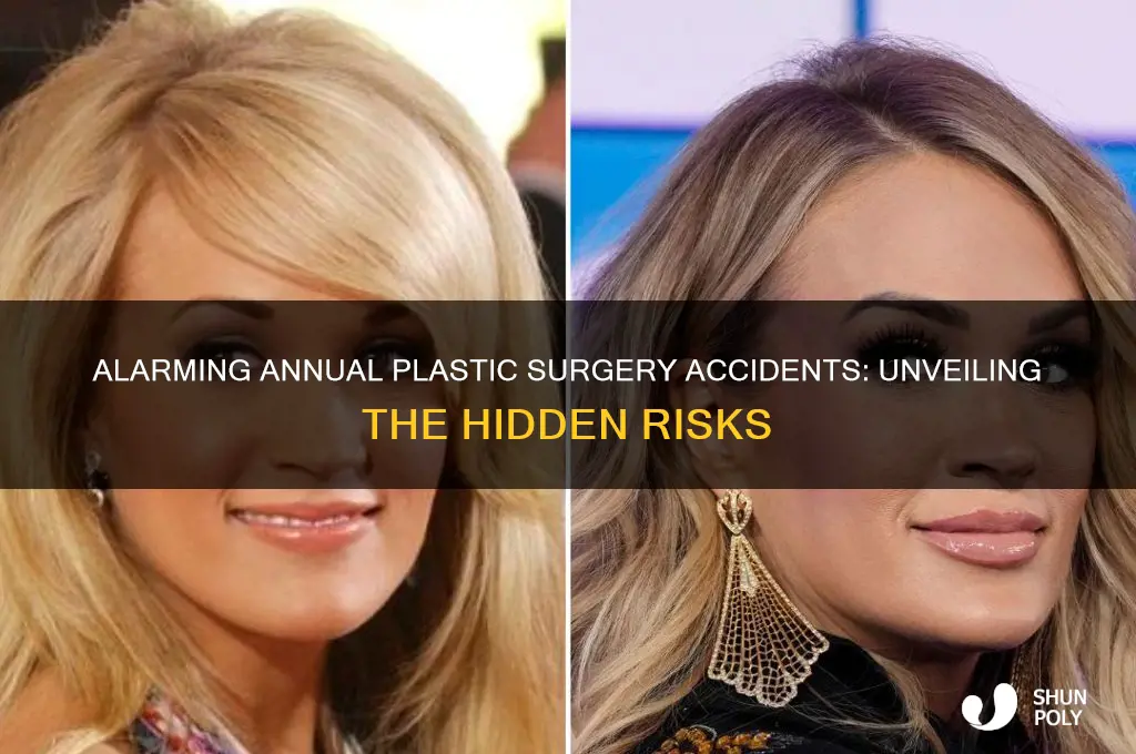 how many plastic surgeries accident happen in a year