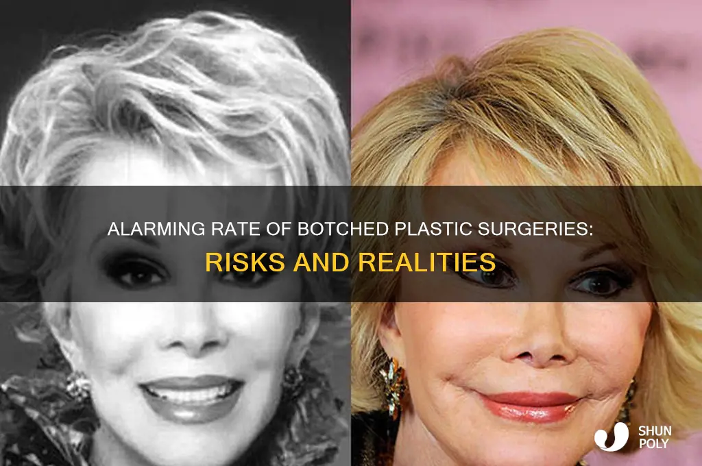 how many plastic surgeries are botched