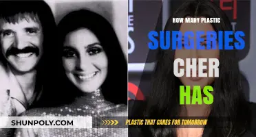 Cher's Transformation Journey: Unveiling Her Plastic Surgery Secrets