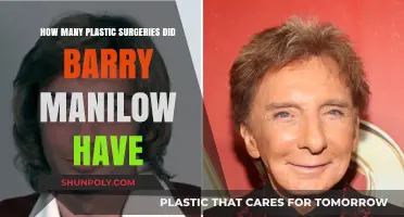 Barry Manilow's Plastic Surgery Journey: Fact-Checking the Rumors