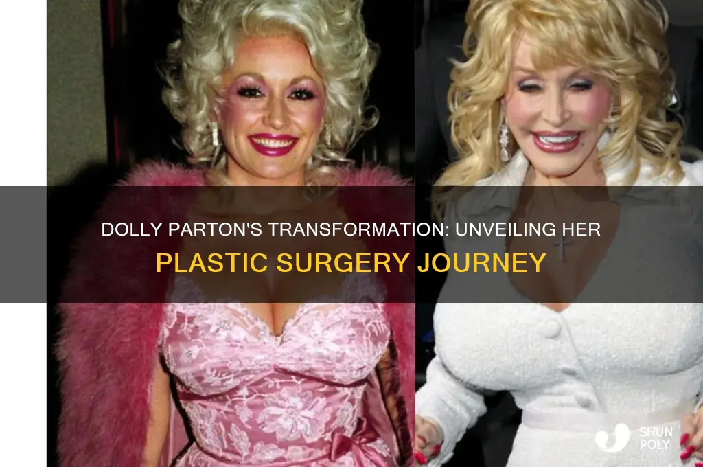 how many plastic surgeries did dolly parton have