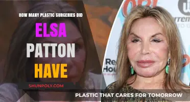 Elsa Patton's Plastic Surgery Journey: Unveiling Her Transformation Secrets