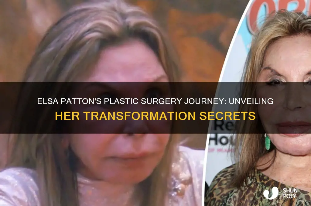 how many plastic surgeries did elsa patton have