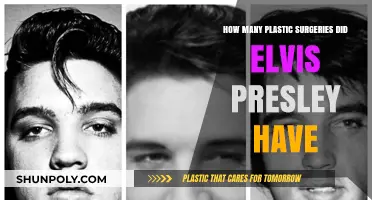 Elvis Presley's Plastic Surgery Journey: Unveiling the King's Transformations