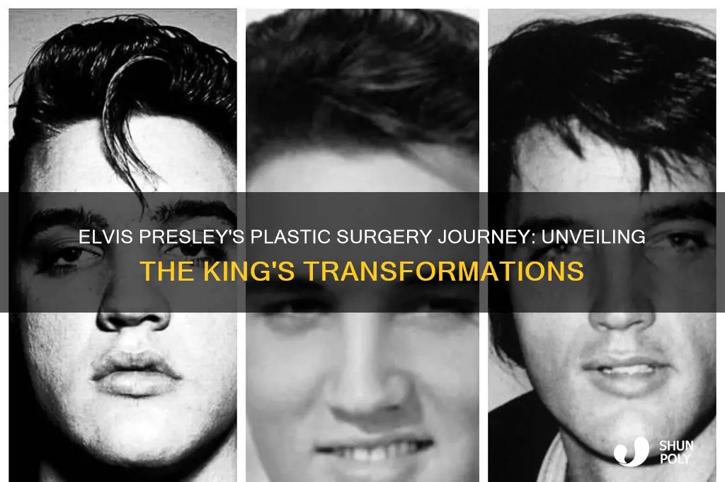how many plastic surgeries did elvis presley have