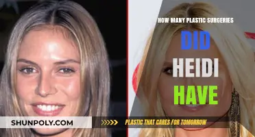 Heidi's Transformation Journey: Unveiling Her Plastic Surgery Count