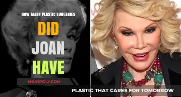 Joan's Transformation Journey: Unveiling Her Plastic Surgery Count