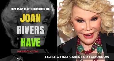 Joan Rivers' Plastic Surgery Journey: Unveiling Her Transformative Procedures