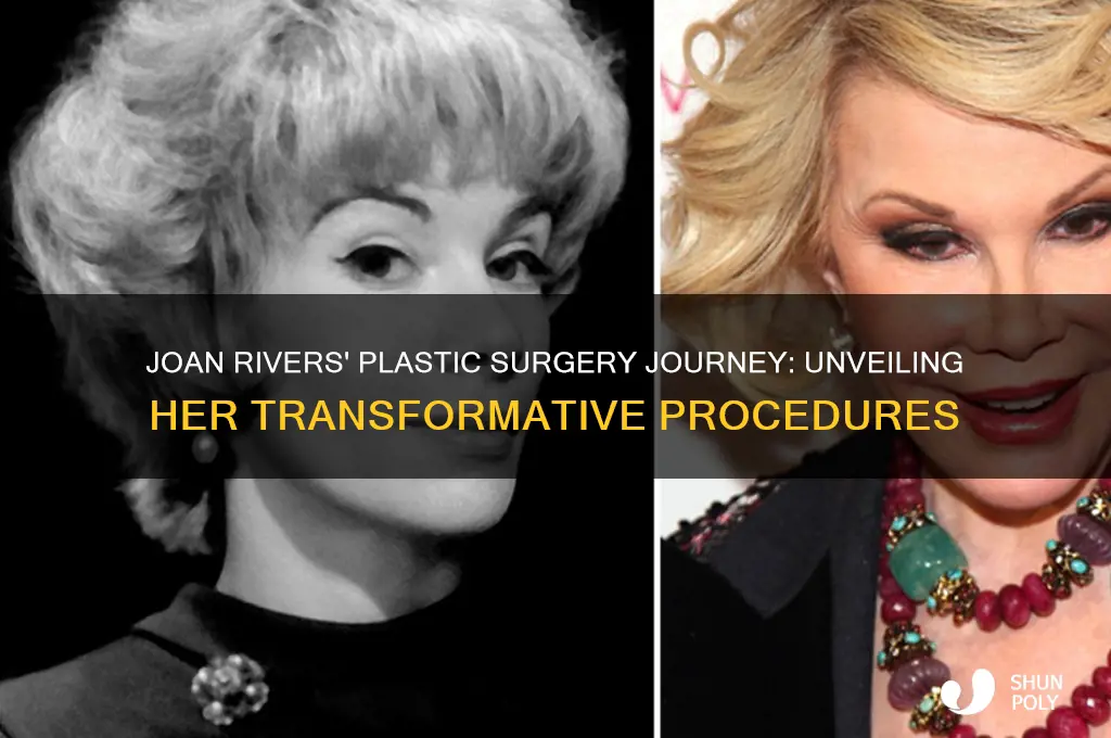 how many plastic surgeries did joan rivers have
