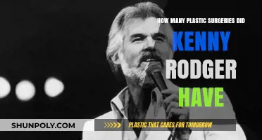 Kenny Rogers' Plastic Surgery Journey: Unveiling the Truth Behind His Transformations