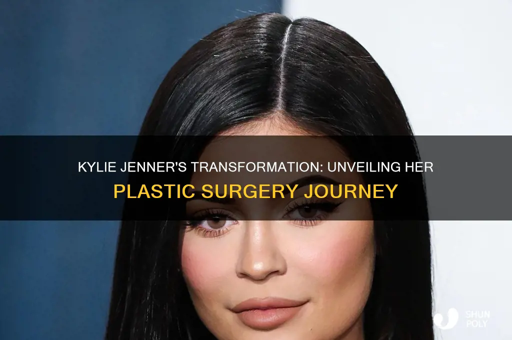how many plastic surgeries did kylie jenner