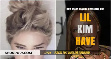 Lil Kim's Transformation Journey: Unveiling Her Plastic Surgery Count