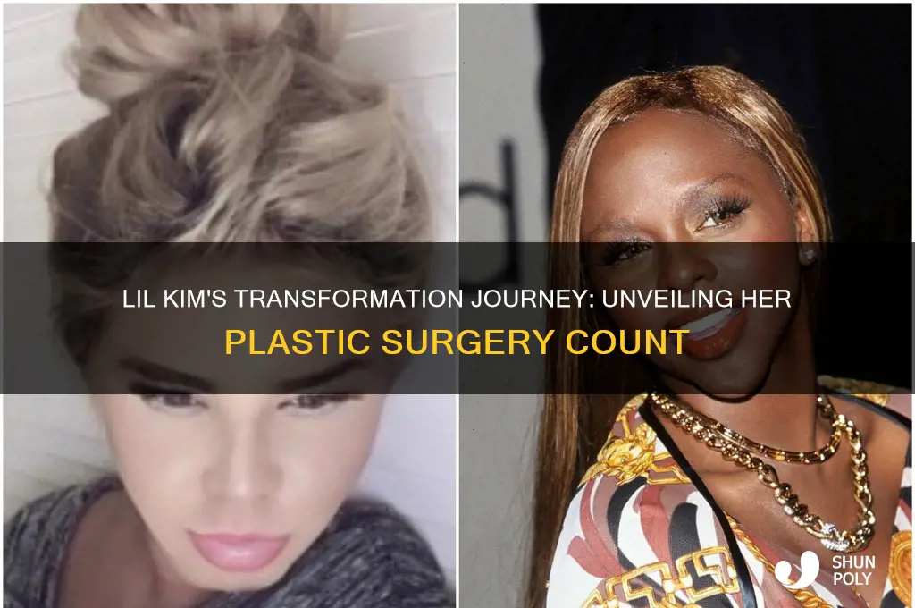 how many plastic surgeries did lil kim have