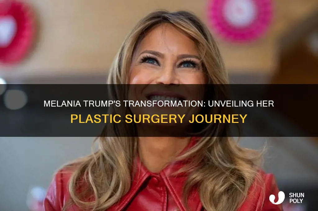 how many plastic surgeries did melania trump get