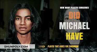 Unveiling Michael Jackson's Plastic Surgery Journey: Fact vs. Fiction