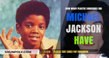 Michael Jackson's Transformation: Uncovering His Plastic Surgery Journey