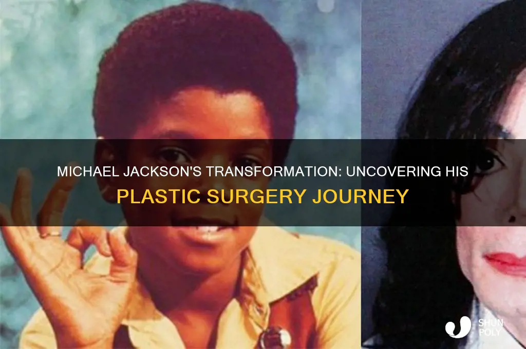 how many plastic surgeries did michael jackson have