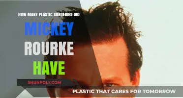 Mickey Rourke's Transformation: Unveiling His Plastic Surgery Journey
