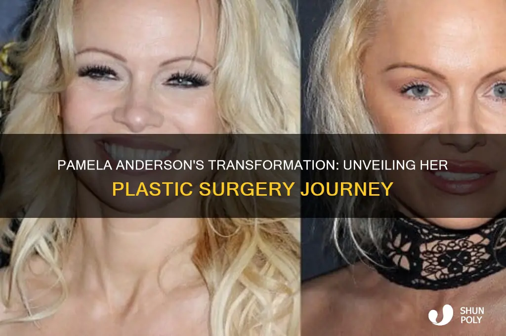 how many plastic surgeries did pamela anderson have