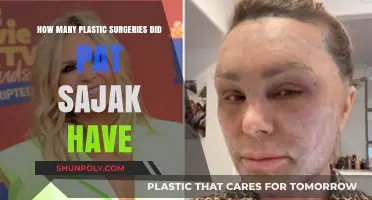 Pat Sajak's Plastic Surgery Journey: Unveiling the Truth