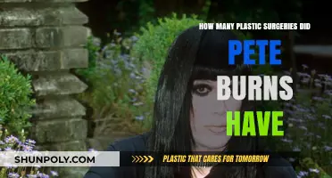 Pete Burns' Plastic Surgery Journey: Unveiling His Transformative Procedures