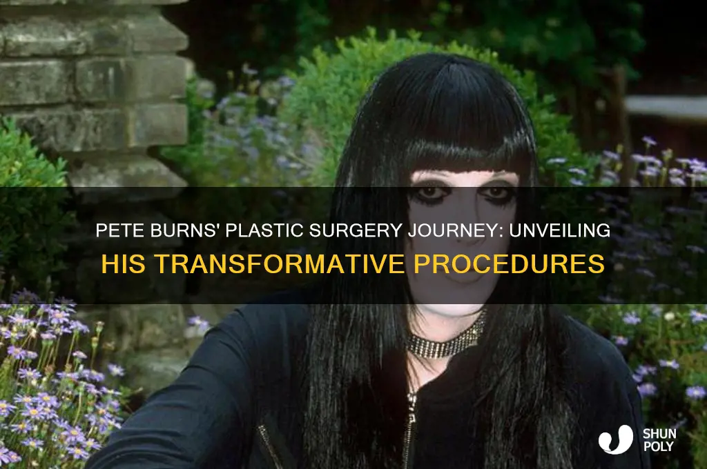 how many plastic surgeries did pete burns have