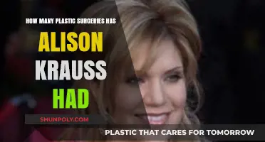 Alison Krauss' Plastic Surgery Journey: Rumors and Reality Explored