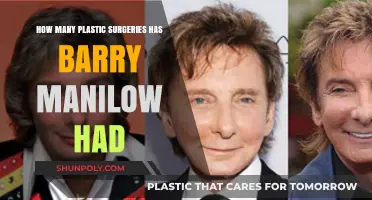 Barry Manilow's Plastic Surgery Journey: Rumors and Reality Revealed