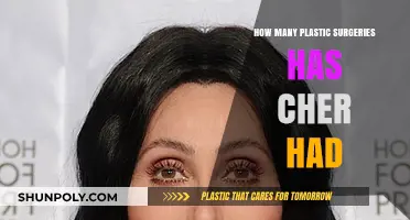 Cher's Transformation Journey: Unveiling Her Plastic Surgery Count