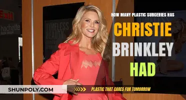 Christie Brinkley's Plastic Surgery Journey: Unveiling Her Transformation Secrets