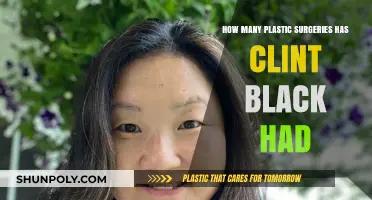 Clint Black's Transformation: Unveiling His Plastic Surgery Journey
