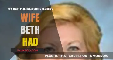 Beth, Dog's Wife: Unveiling Her Plastic Surgery Transformation Journey