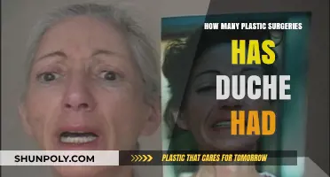 Duche's Plastic Surgery Journey: Unveiling the Transformation Count