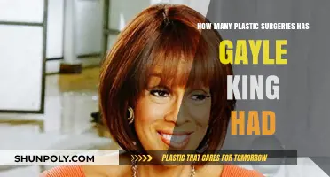 Gayle King's Plastic Surgery Journey: Rumors, Facts, and Transformation