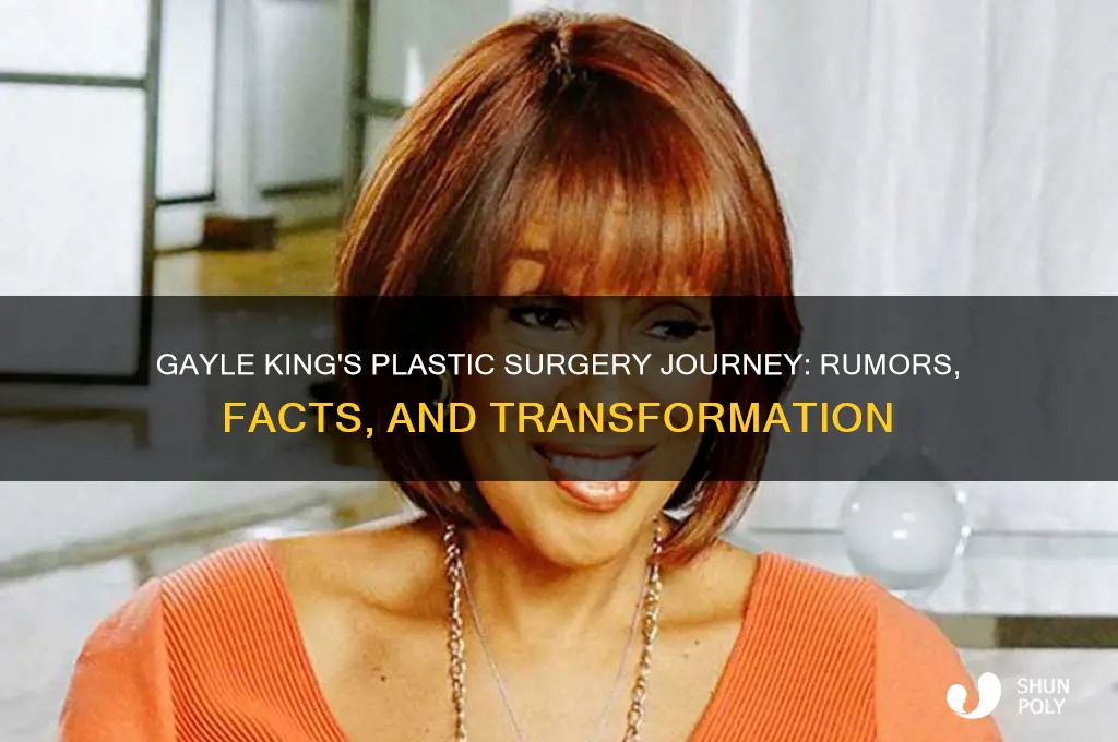 how many plastic surgeries has gayle king had