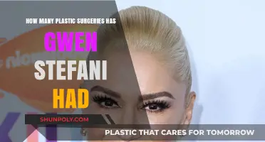 Gwen Stefani's Transformation: Unveiling Her Plastic Surgery Journey