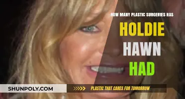 Goldie Hawn's Transformation: Exploring Her Plastic Surgery Journey