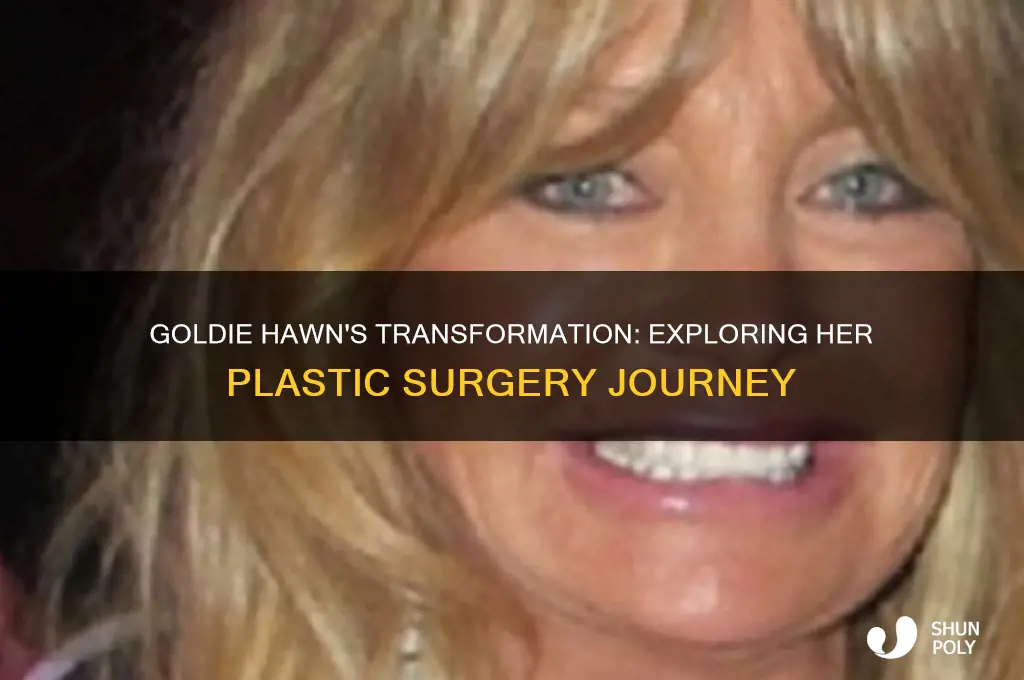 how many plastic surgeries has holdie hawn had
