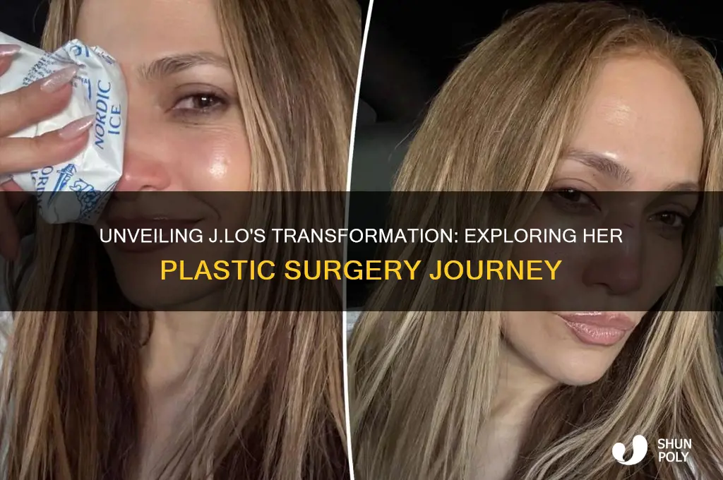 how many plastic surgeries has j lo had