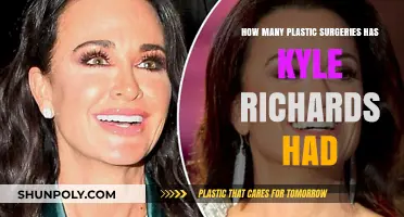 Kyle Richards' Plastic Surgery Journey: Procedures and Transformations Revealed