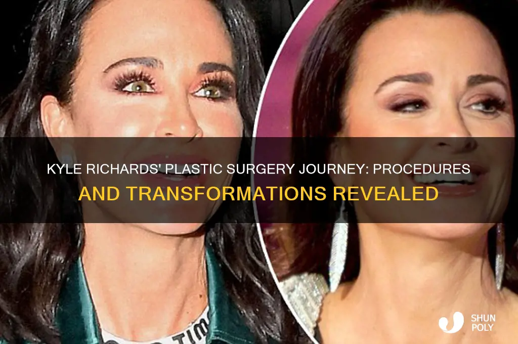 how many plastic surgeries has kyle richards had