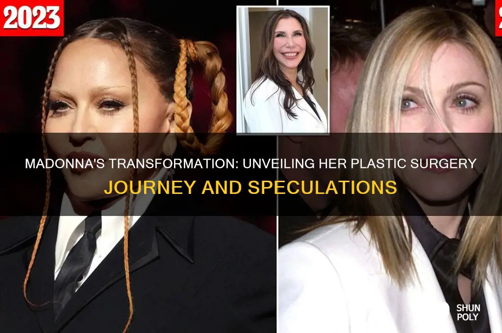how many plastic surgeries has madonna had