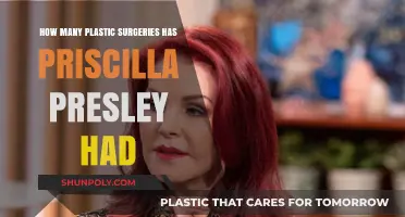 Priscilla Presley's Transformation: Unveiling Her Plastic Surgery Journey