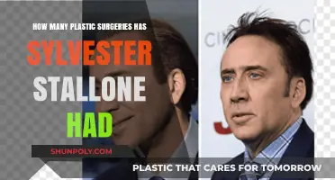 Sylvester Stallone's Plastic Surgery Journey: Fact-Checking the Rumors