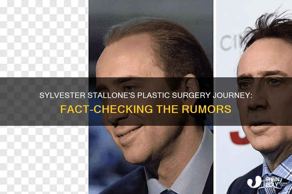 how many plastic surgeries has sylvester stallone had